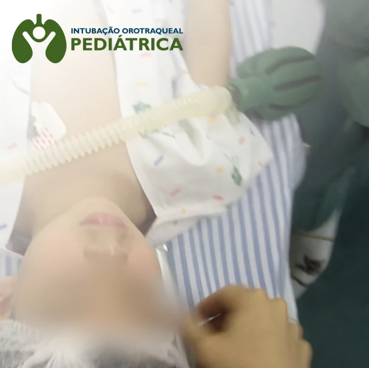 Intubação Pediátrica