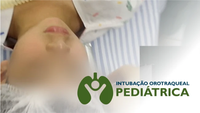 Intubação Pediátrica