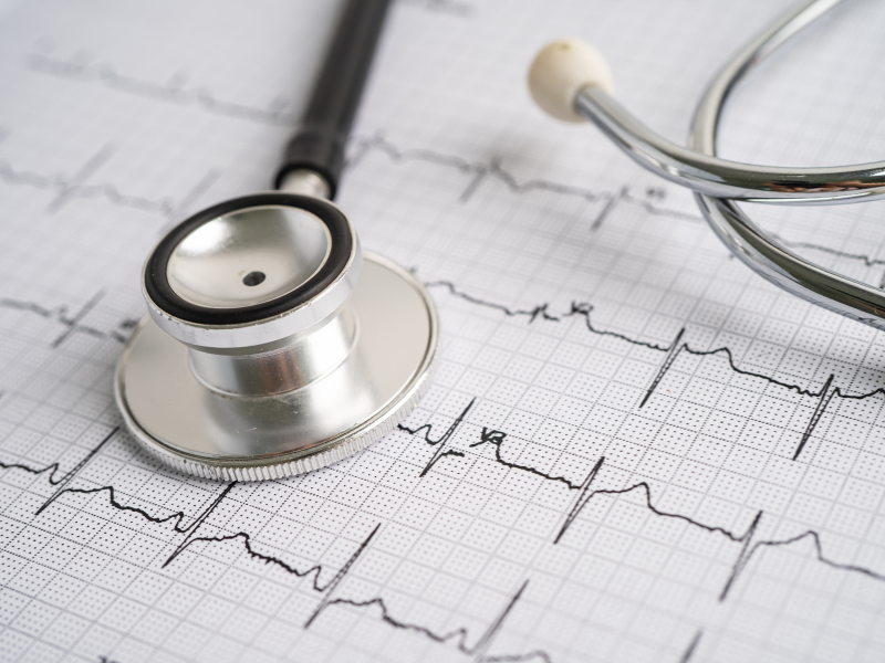 como fazer eletrocardiograma