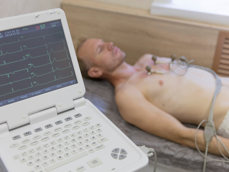 como interpretar um eletrocardiograma