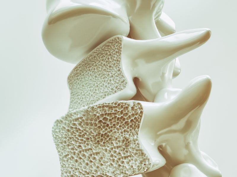 osteoporose primária e secundária