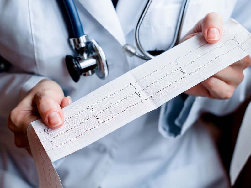 como ler um eletrocardiograma análise
