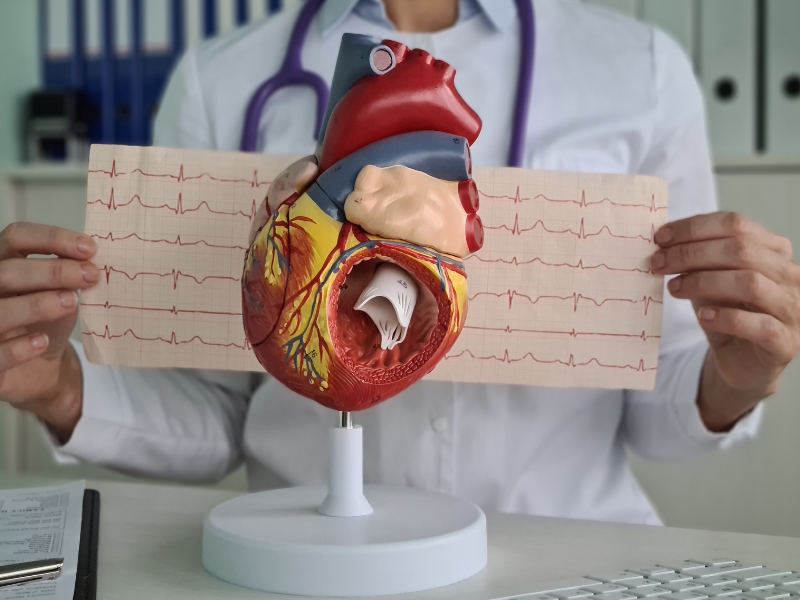 como ler um eletrocardiograma ecg
