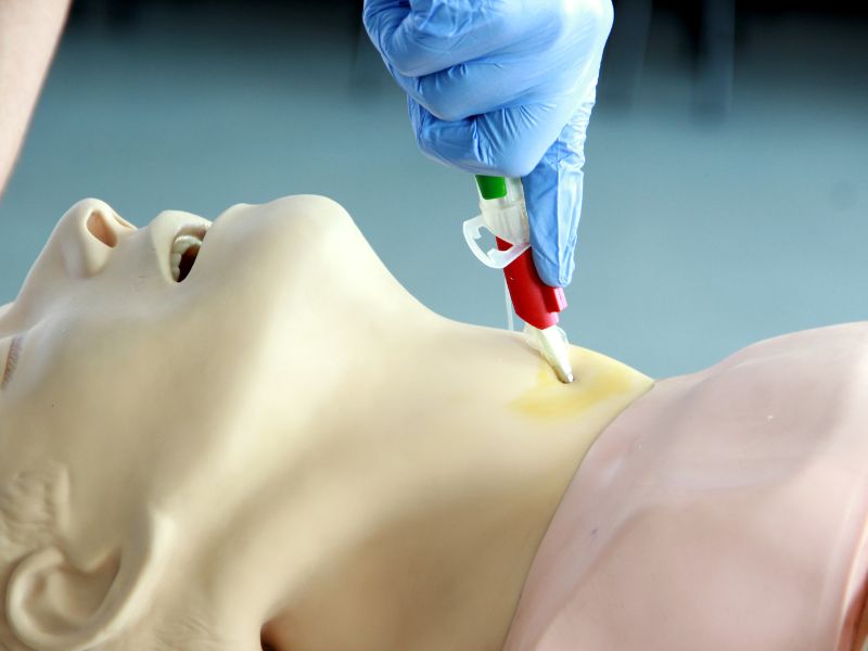 traqueostomia tem risco de morte procedimento