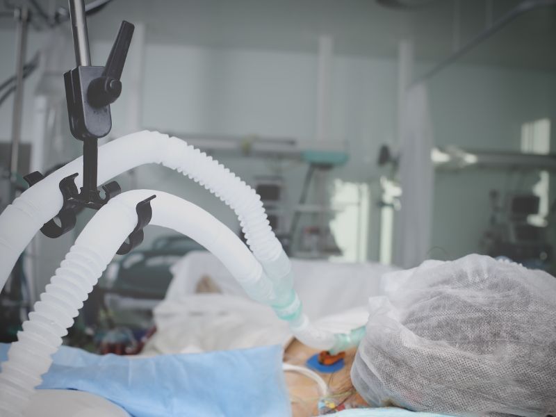 o que é PCV na ventilação mecânica e fundamentos
