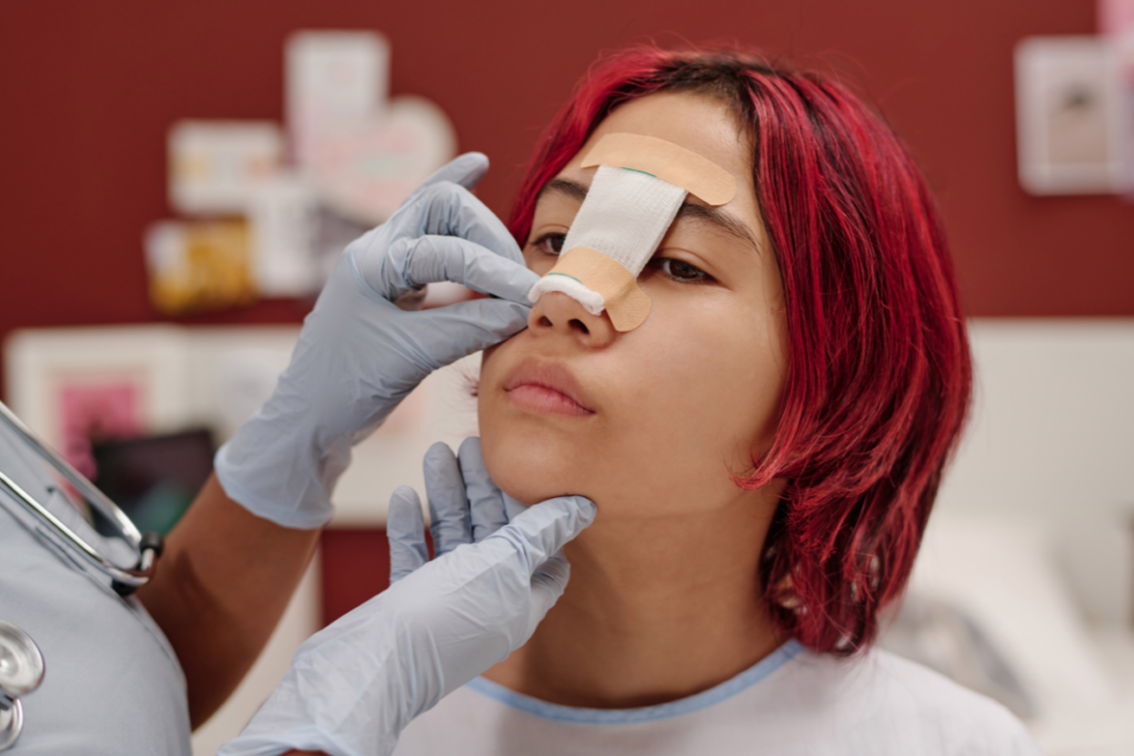 paciente rinoplastia