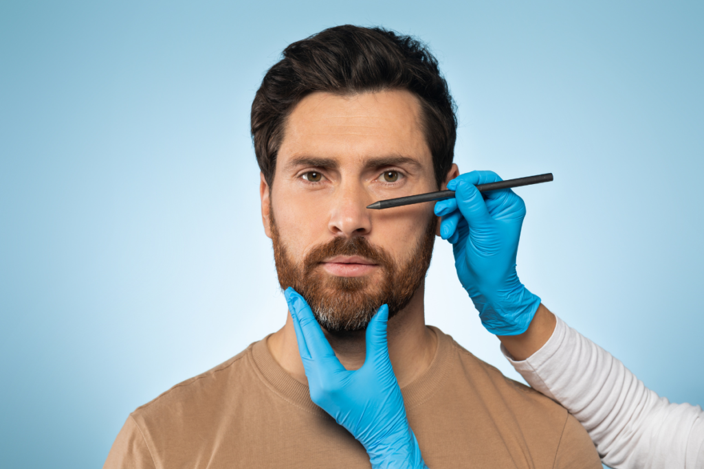 rinoplastia-masculina