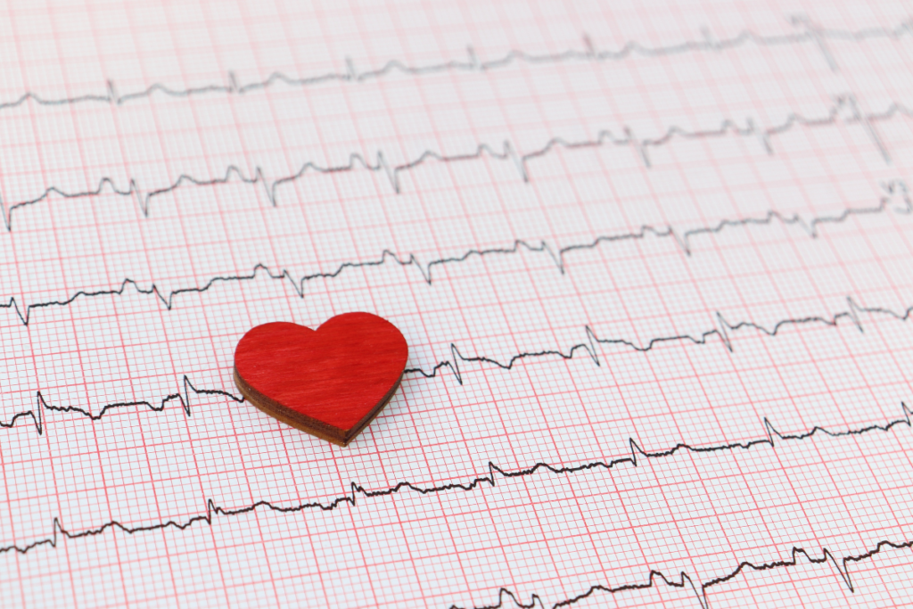 Bloqueio de ramo ECG