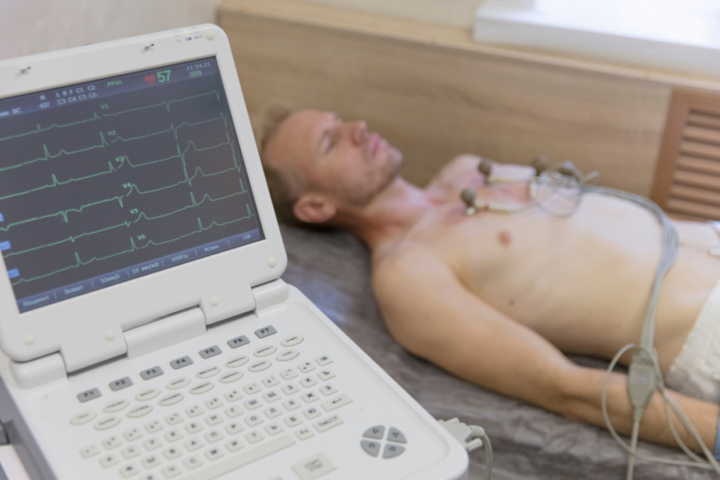 Taquicardia ventricular ECG