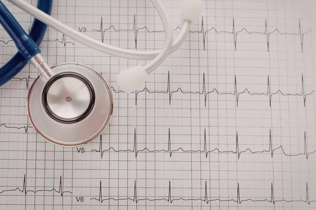 alterações potássio ECG