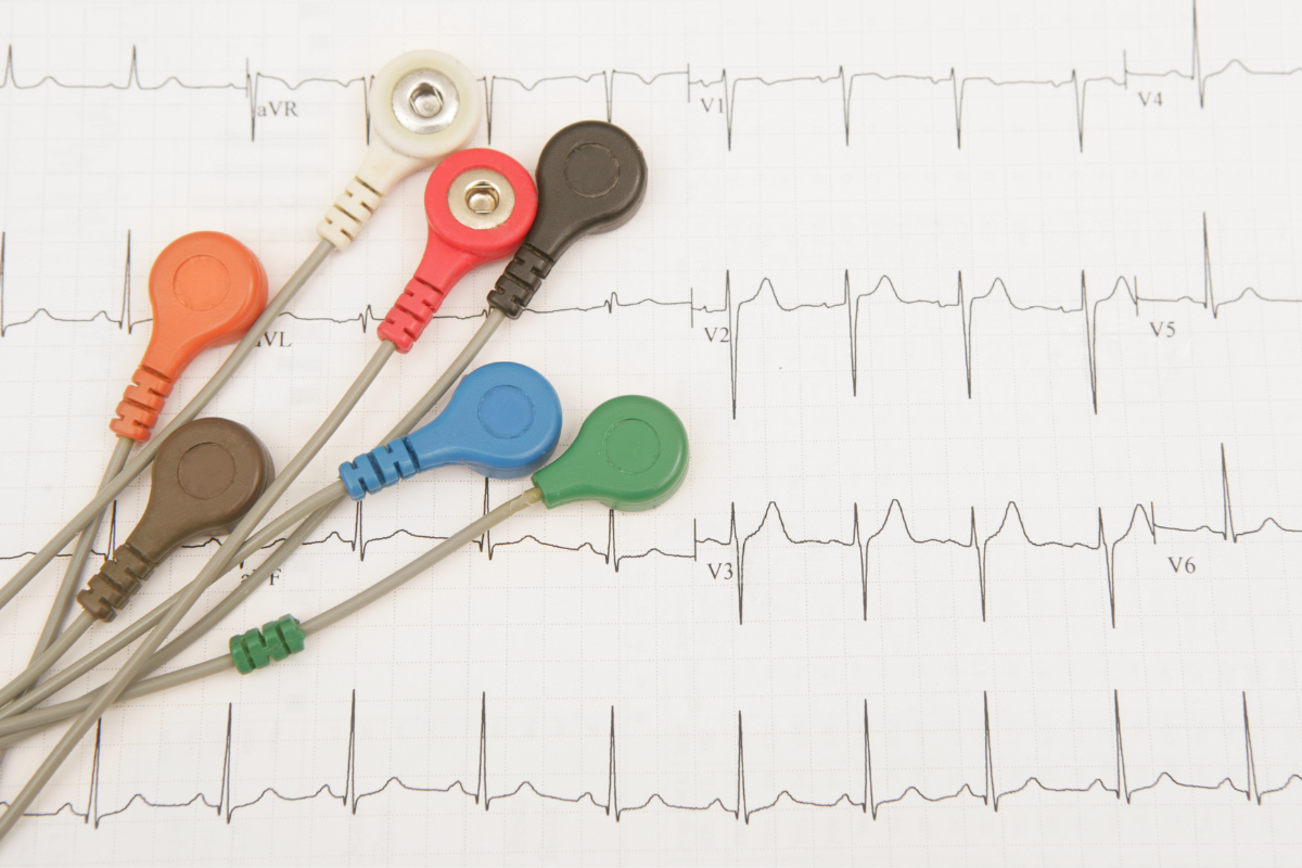 alterações potássio ECG