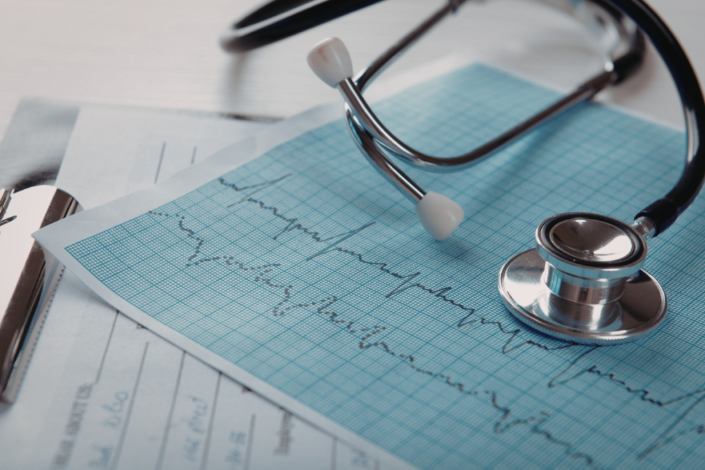 fibrilação atrial no ECG