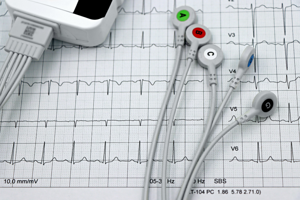 flutter atrial ECG