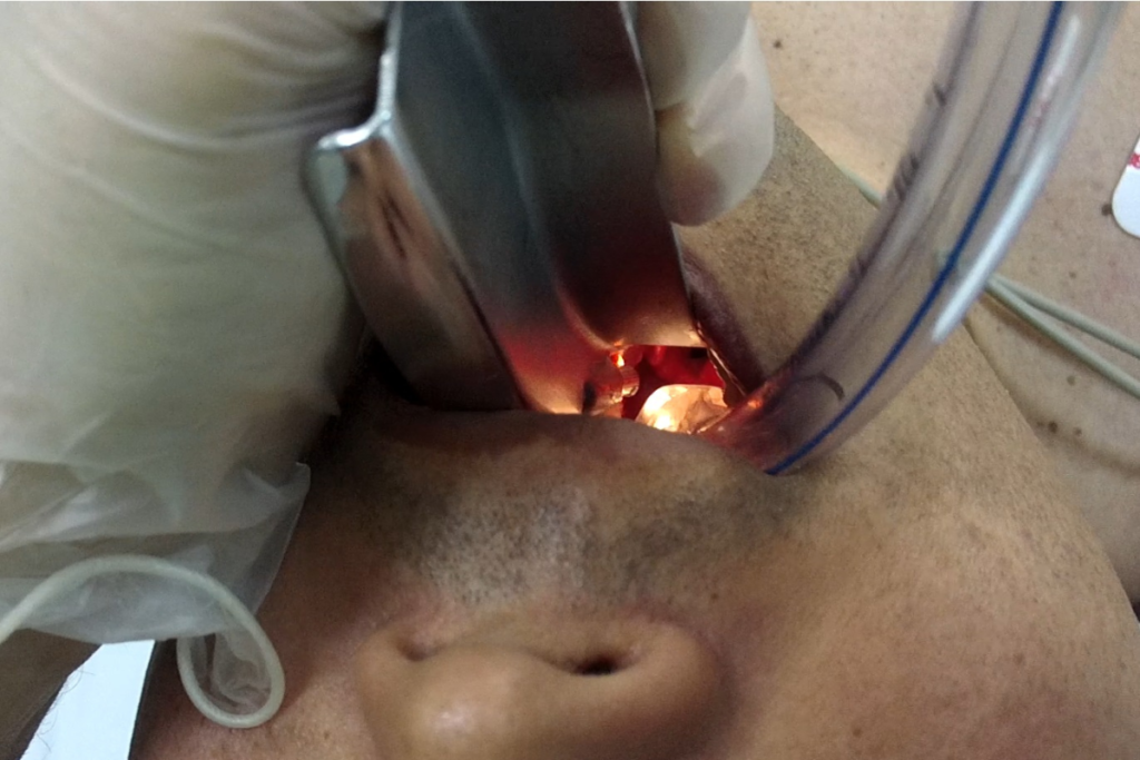 midazolam sedação doses