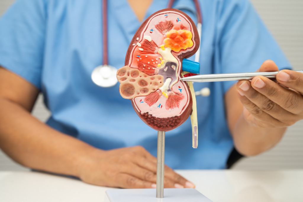 insuficiência renal aguda critérios KDIGO