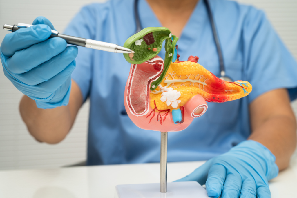 pancreatite aguda critérios de gravidade