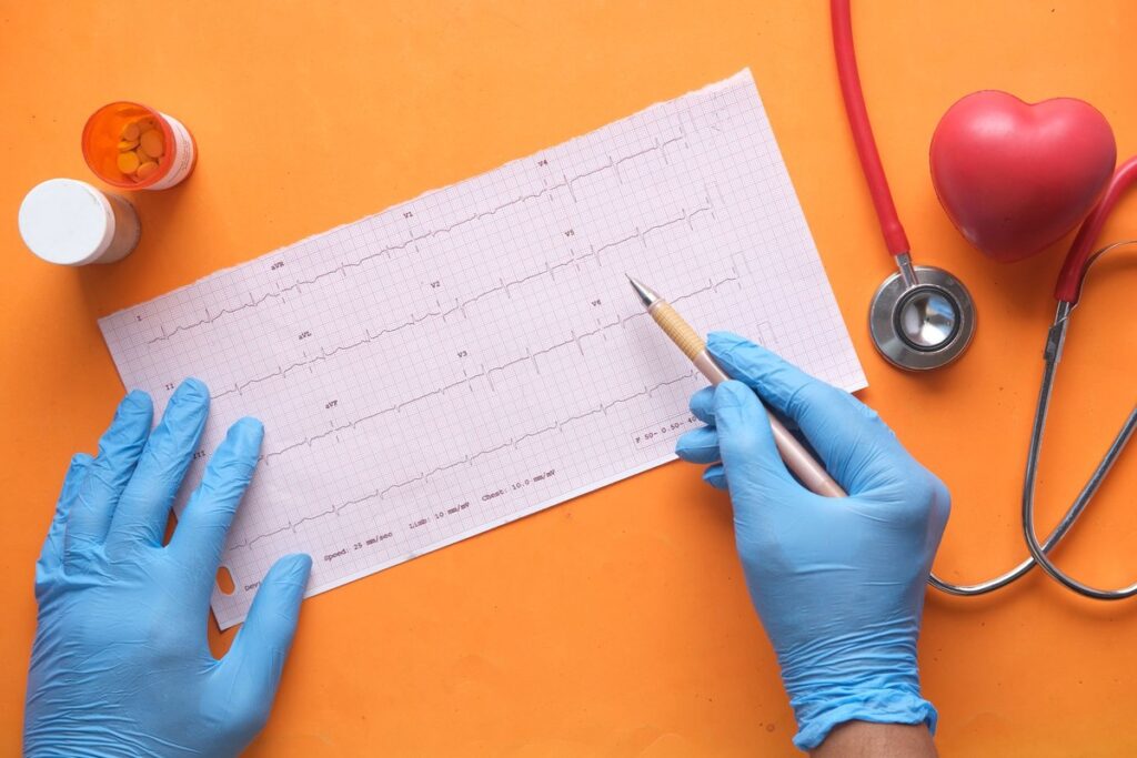 fibrilação atrial