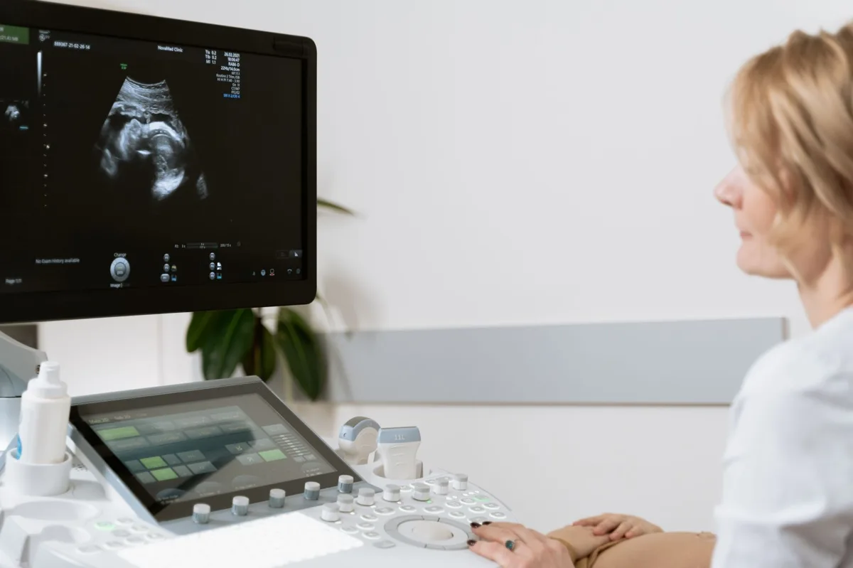investigação do sangramento uterino anormal