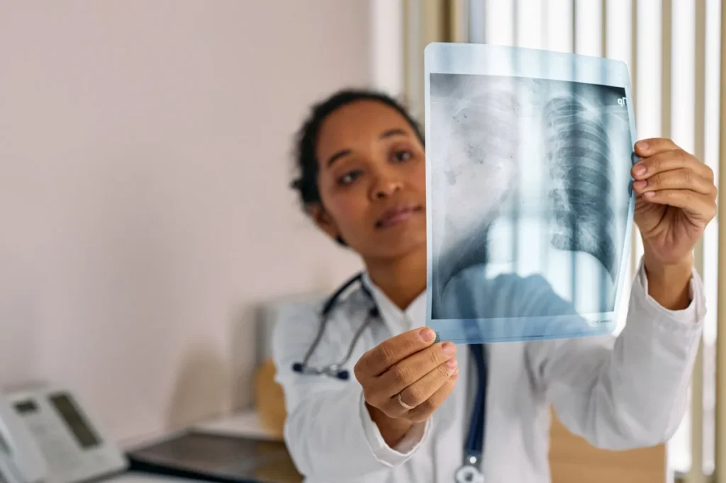 tratamento da pneumonia adquirida na comunidade