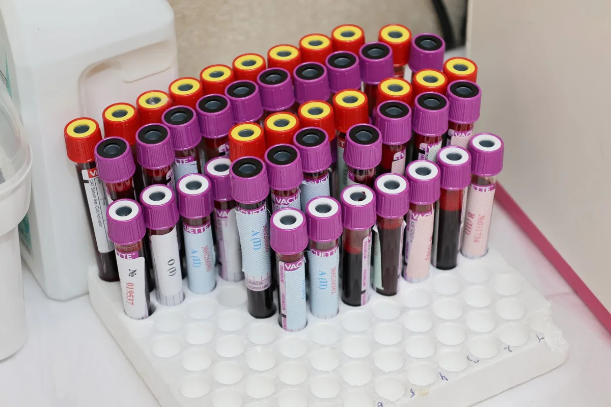 diagnóstico da deficiência de vitamina B12