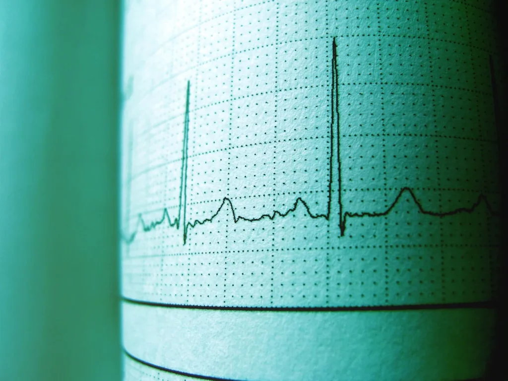 anticoagulação na fibrilação atrial