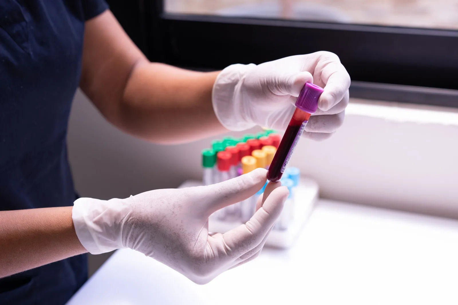 tratamento da dislipidemia com estatinas