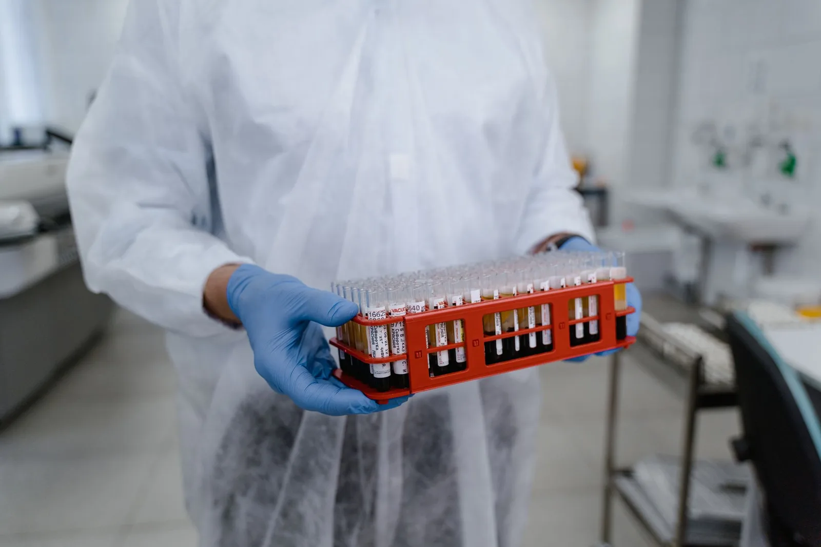 tratamento da infecção urinária
