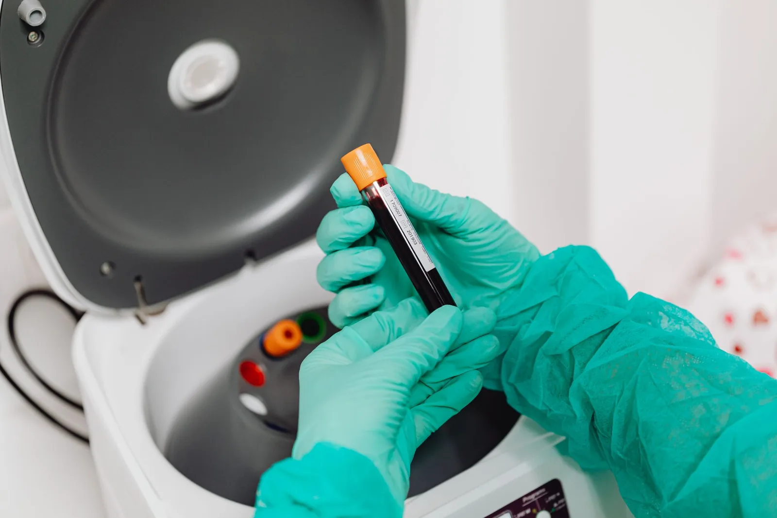 tratamento da anemia ferropriva