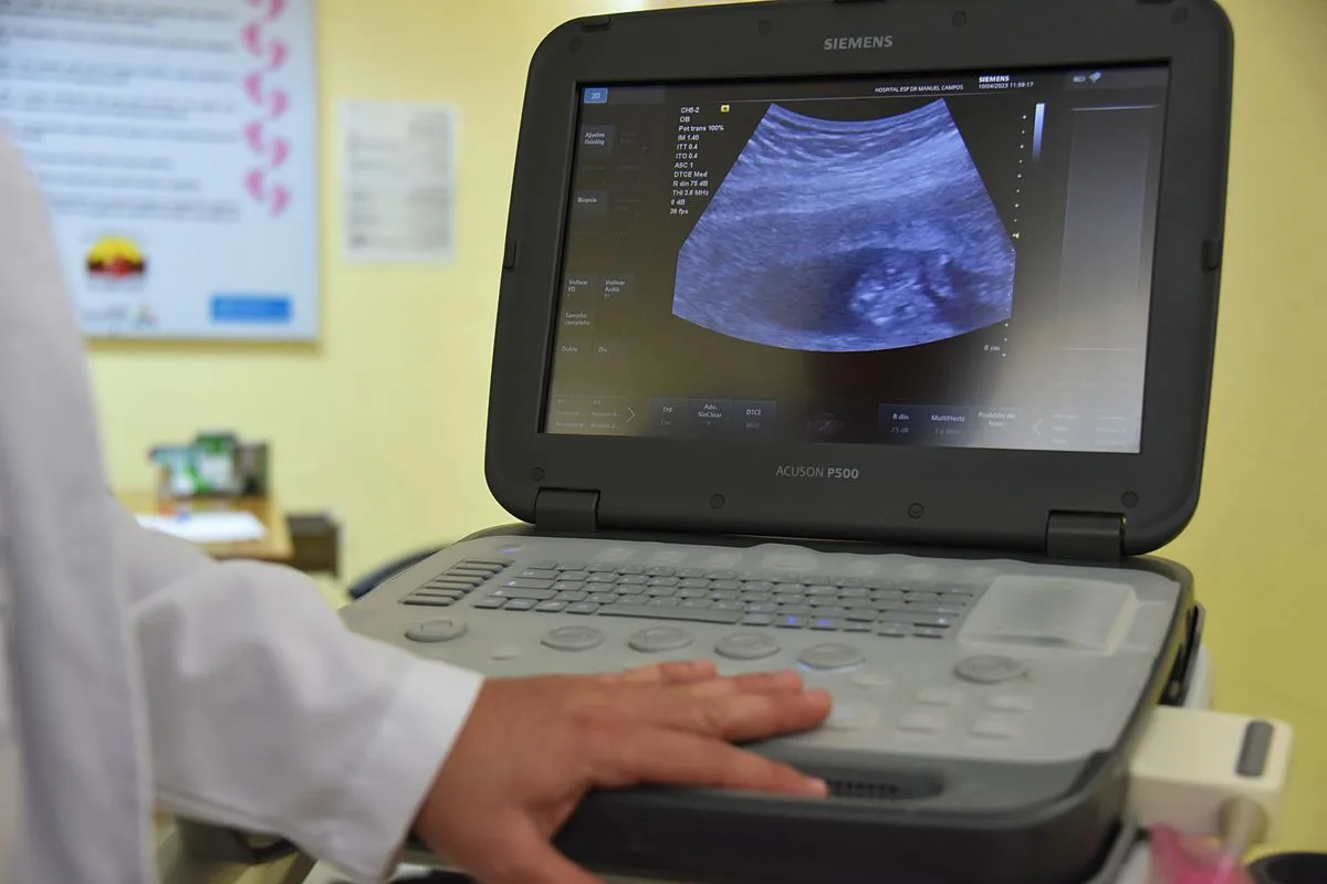 DIU hormonal endometriose plano de saúde